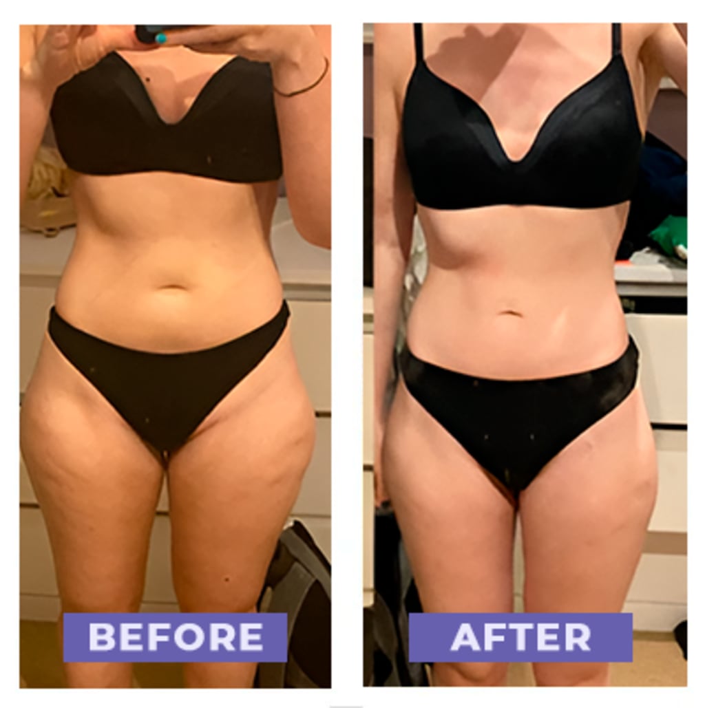 Carebudd™ Anti-Cellulite Suction Cup draft