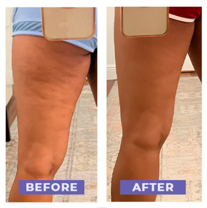 Carebudd™ Anti-Cellulite Suction Cup draft